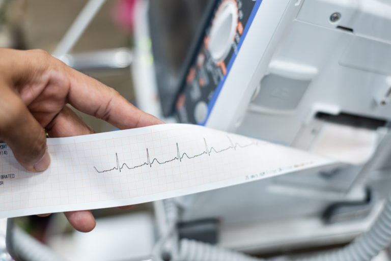 What is an EKG Used For? - Amory Urgent Care